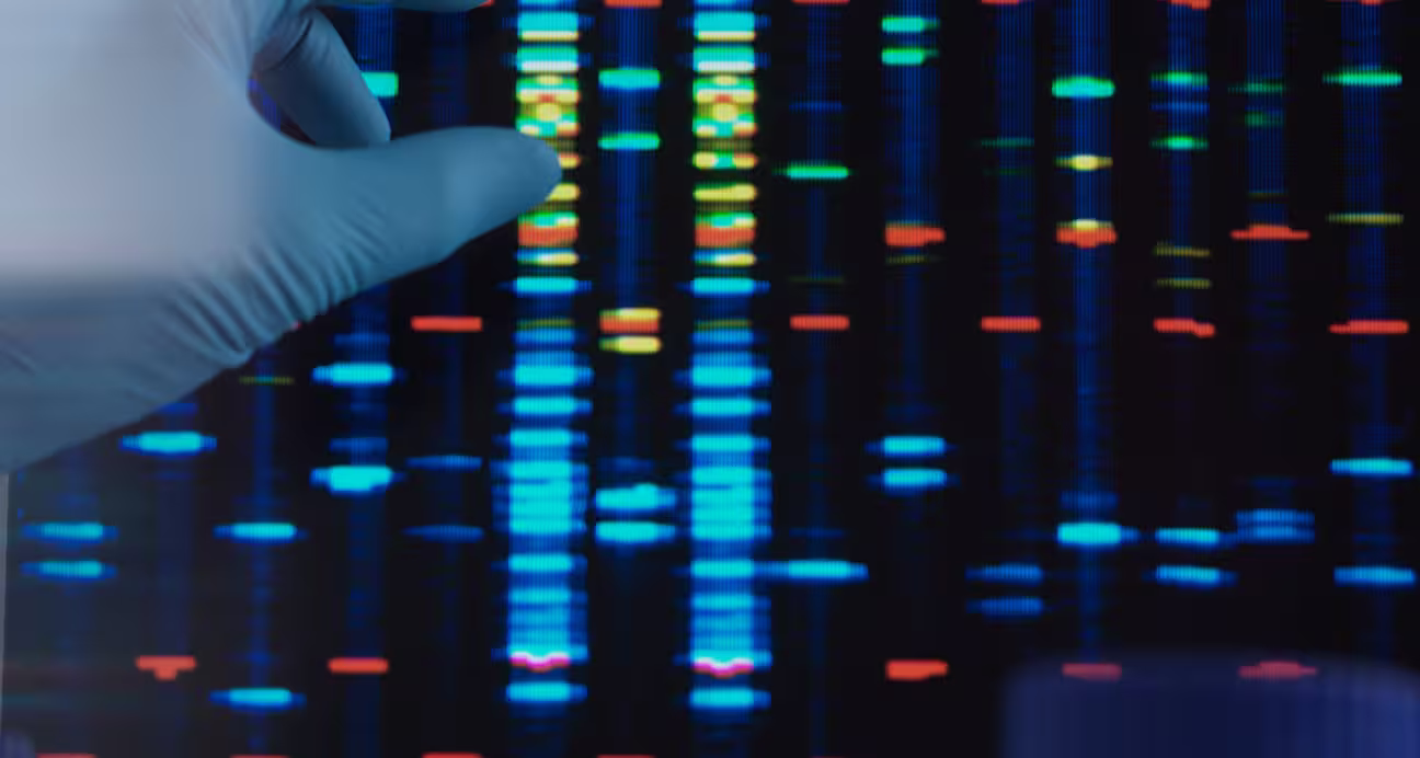 Plasmid DNA — primary photograph